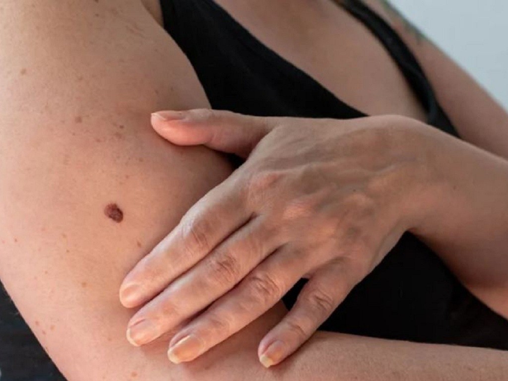5-ngua-da-shuttestock-1690732554270288766613-1778158043.jpg