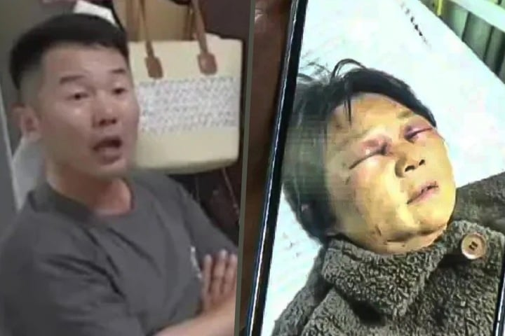 me-ruot-bi-vo-danh-gay-4-xuong-suon-con-trai-dung-dung-thot-ra-mot-cau-khien-cong-dong-mang-day-song-dspl-1-1784084025.png