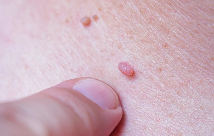 hpv4-1786524150.jpg