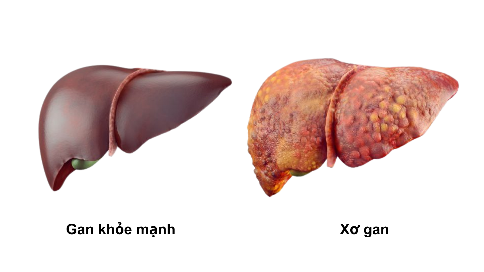 xo-gan-1753678371.png