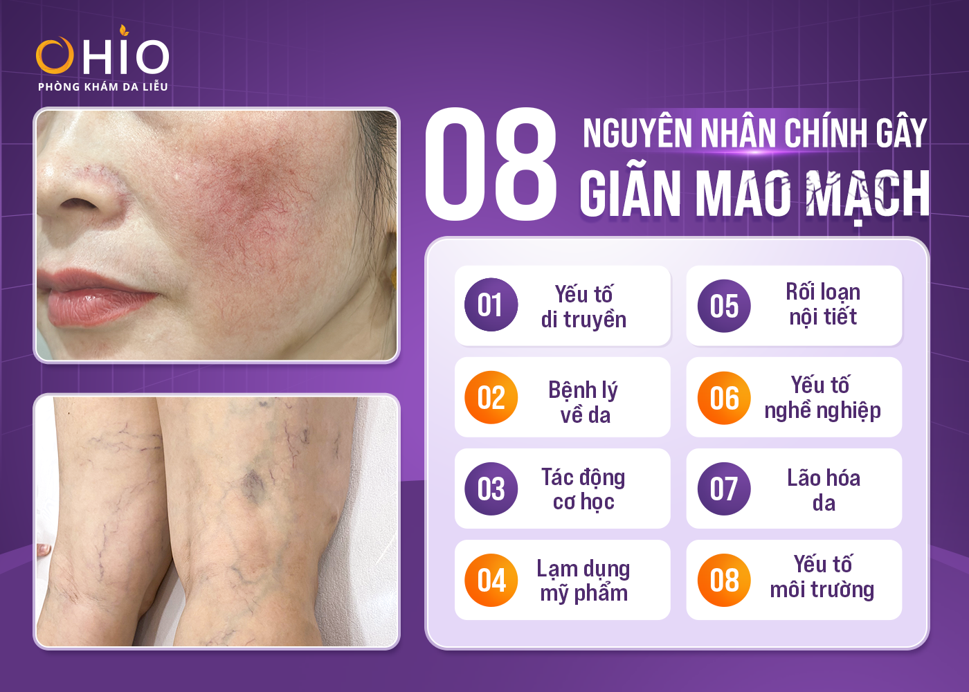 anh00271-1755350378.png