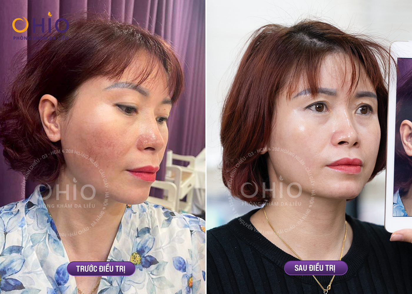 anh00274-1755350382.png