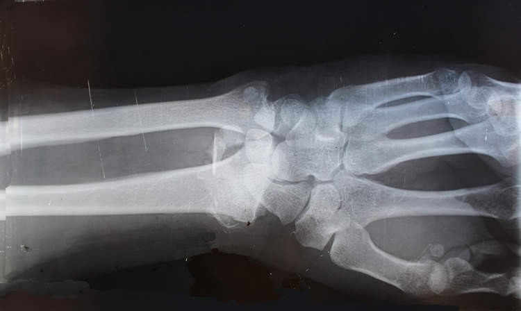 bone-02-1759393457.jpg