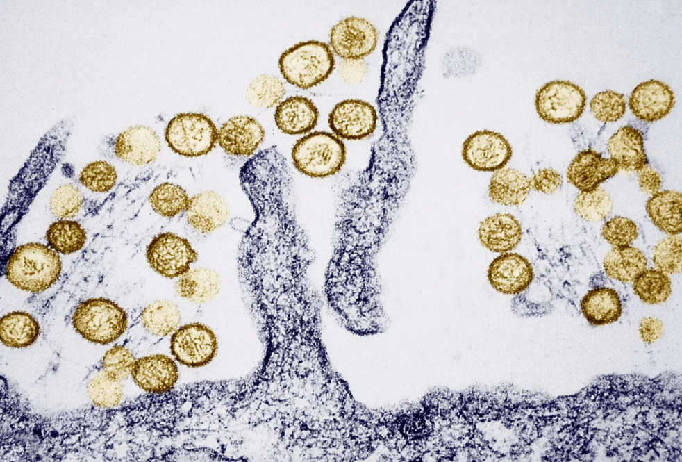 virus-hanta-1-1778380077.png