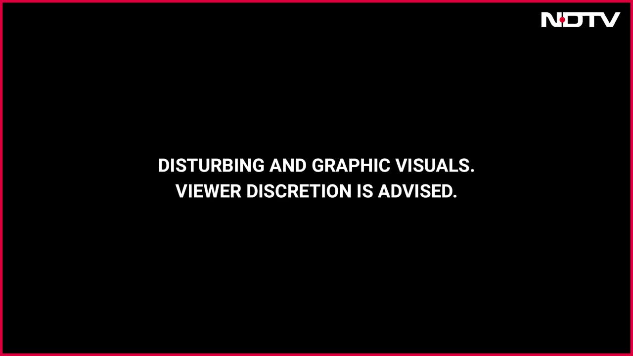 delhi-boy-loses-ear-in-shocking-pit-bull-attack-dog-owner-arrested-1764061914.mp4