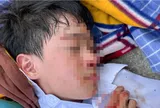 Nam sinh lớp 6 bị đánh chảy máu đầu phải nhập viện ở Nha Trang: Bất ngờ lý do gia đình không yêu cầu xử lý