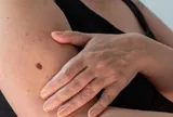 Tưởng dị ứng thời tiết, cô gái trẻ nhận "án tử" ung thư gan vì bỏ qua dấu hiệu ai cũng từng gặp