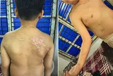 Khởi tố người cha đánh con ruột thương tích 36%: Bàng hoàng công cụ gây án