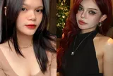 Từ ca ung thư máu của TikToker 23 tuổi: Gặp những dấu hiệu này phải đi khám bác sĩ ngay!
