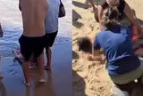 Rùng mình khoảnh khắc cô gái 19 tuổi ở Brazil bị cá mập tấn công, đứt chân phải khi đang tắm biển