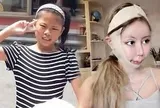 Cô gái chi hơn 15 tỷ đồng phẫu thuật thẩm mỹ để giống thần tượng, trải qua hơn 100 lần “dao kéo” quyết định dừng lại sau khi nhận ra sự thật đáng sợ