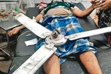 Đang nằm cấp cứu, bệnh nhân bị quạt trần rơi trúng, tử vong thương tâm