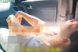 Cãi nhau với chồng, người phụ nữ gặp tình trạng khó tin khiến bác sĩ cũng phải sững sờ