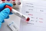 Cô gái 29 tuổi sụp đổ khi cầm kết quả dương tính HIV, chi tiết "đêm định mệnh" khiến người mê app hẹn hò toát mồ hôi hột