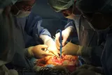 4 giờ sinh tử trong phòng mổ: Sản phụ mất gần 10 lít máu, các bác sĩ chạy đua giành sự sống
