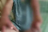 Vừa sạc vừa dùng điện thoại trên giường, người phụ nữ bị bỏng đến mức cả 10 ngón tay không còn nguyên vẹn