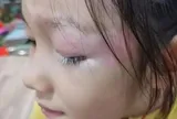 Con gái xinh xắn bỗng mọc lông mi màu trắng kỳ lạ, mẹ hoang mang đưa đến bệnh viện khám, bác sĩ lắc đầu