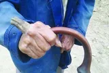 Cụ ông 98 tuổi phải sống chung với "chiếc sừng" kỳ lạ dài tới 10 cm suốt gần 10 năm trời