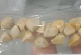 Ngày nào cũng uống trà đá, người phụ nữ đi khám mới bàng hoàng phát hiện cả "ổ" sỏi trong cơ thể: Bác sĩ cảnh báo điều này