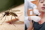 Bị muỗi đốt suýt chết sau khi tập thể dục