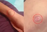 Thấy con trai người đầy vết thương, bố mẹ chết lặng khi nghe em kể chuyện đau lòng xảy ra suốt 2 năm ở trường
