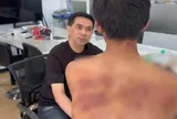 Đi làm với nhiều vết thâm tím trên người, sếp hỏi chuyện mới phát hiện câu chuyện bạo hành kéo dài gần 10 năm của nam thanh niên 18 tuổi