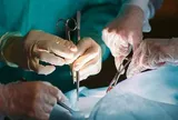 Vào viện vì đau bụng, phải cắt bỏ toàn bộ dạ dày: Sự thật được hé lộ sau 3 tháng khiến người đàn ông suy sụp