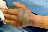 Chặt đầu con rắn hổ mang, 5 phút sau người đàn ông định nhặt lên thì bị cắn 1 cú chí mạng