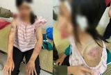 Bé gái 13 tuổi bị bà nội và hai người đàn ông đánh bầm dập: Xót xa hoàn cảnh quá éo le