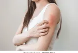 Tưởng dị ứng thời tiết, cô gái trẻ nhận "án tử" ung thư gan vì bỏ qua dấu hiệu ai cũng từng gặp