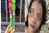 Bé gái 5 tuổi khóc thét sau vài phút chơi bong bóng xà phòng, bác sĩ cảnh báo nguy hiểm