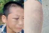 “O ơi cứu cháu với”: Lời cầu cứu xót xa của bé trai nghi bị cha và mẹ kế bạo hành ở Nghệ An