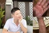 Điều bất ngờ về căn bệnh lạ khiến NSƯT Chí Trung ngứa ngáy khắp cơ thể, mất ngủ triền miên