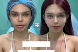 Nhan sắc tranh cãi của nữ tiktoker "nghiện thẩm mỹ", sau 15 lần "đập đi xây lại"