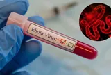 Ebola diễn biến phức tạp, tử vong lên đến 90%: Việt Nam siết phòng dịch