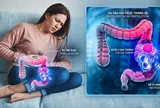 Ung thư đại trực tràng ở phụ nữ: Những triệu chứng âm thầm đừng nên ngó lơ