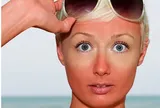 5 cách làm dịu da sau khi đi nắng, đơn giản mà hiệu quả bất ngờ