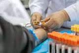 Bác sĩ nhắc nhở: Nếu cánh tay xuất hiện 4 dấu hiệu này, đừng chần chừ đi khám
