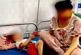 Triệu tập người cha dượng nghi bạo hành bé trai 3 tuổi ở Gia Lai