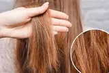 Rụng tóc nhiều vào mùa hè đừng chủ quan: 5 thói quen âm thầm gây hại