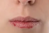 Muốn có một đôi môi hồng hào, căng mọng bạn hãy dừng lại ngay những thói quen này