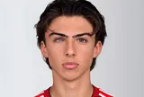 Con trai HLV Mikel Arteta gây chú ý với đôi mắt hai màu hiếm gặp