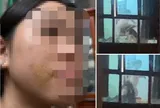 Diễn biến vụ bé gái bị mẹ kế bạo hành ở Phú Thọ, xót xa lời kể về những lần bị đánh
