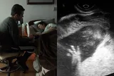 Siêu âm phát hiện con dị tật, nghe lời bác sĩ chọn phá thai, bế em bé trên tay bố mẹ sững sờ