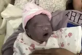 Con vừa chào đời đã có làn da tím khác thường, bố mẹ lo lắng, nào ngờ 2 tháng sau nhận không ra con