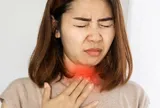 Viêm họng do virus và vi khuẩn khác nhau thế nào?