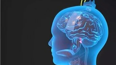 Bệnh nhân trẻ tuổi đột quỵ gia tăng trong dịp Tết