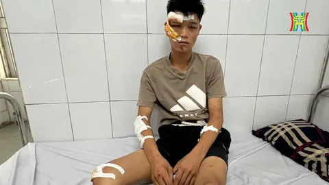 "Quái xế" thông chốt bảo vệ A80, tông cảnh sát cơ động chấn thương sọ não: Nước mắt ngắn dài nói về giây phút tội đồ