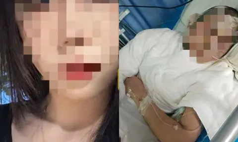 Tiếng kêu cứu từ phía gia đình cô gái 20 tuổi bị bạn trai cũ lừa vào nhà nghỉ để bạo hành