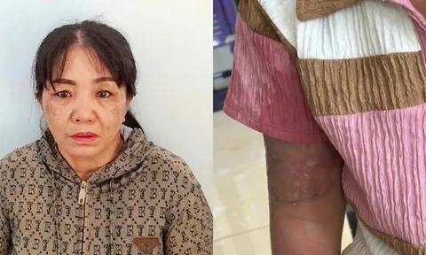 Kiên Giang: Bắt khẩn cấp mẹ nuôi tạt nước sôi vào người bé 12 tuổi